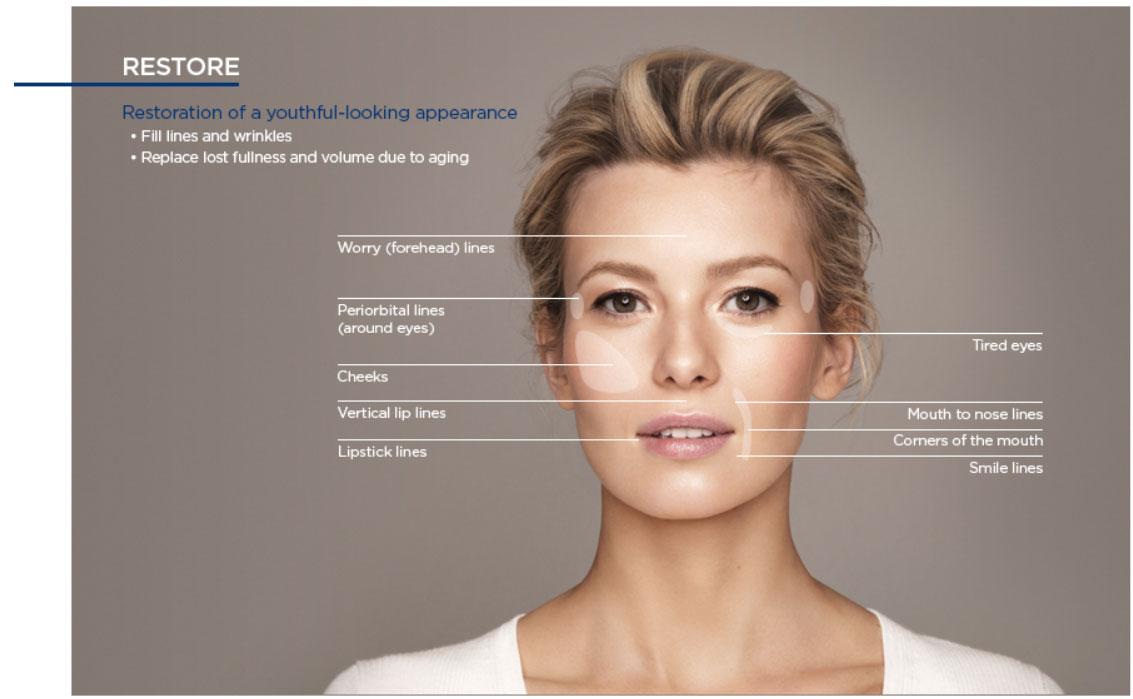 Botox treatments performed on areas of the face in Calgary