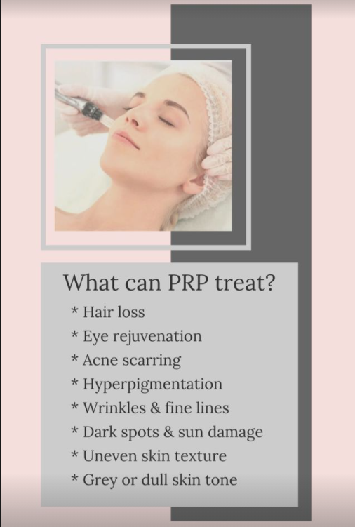 PRP treatment types in Calgary